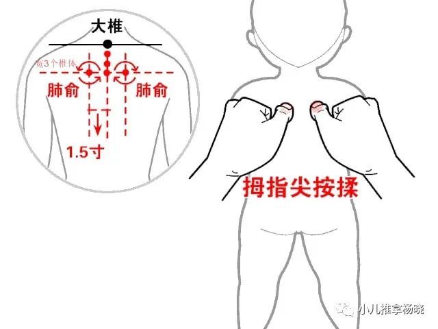 八个月宝宝扁桃体发炎，了解、预防与治疗