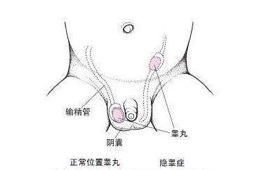 八个月宝宝睾丸图，发育、健康与关怀